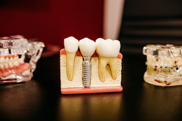 Implante Dental De Titanio Con Corona de Zirconio